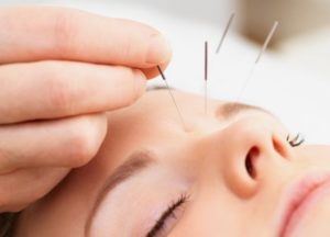acupuncture for allergies dreamclinic massage bellevue redmond seattle
